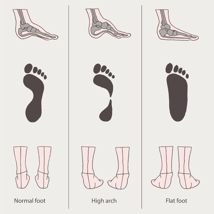Foot Arch