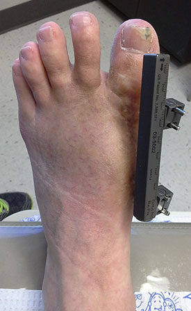 Foot and Ankle Surgery