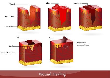 Wound Care