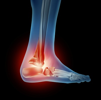 ankle pain podiatrist dallas