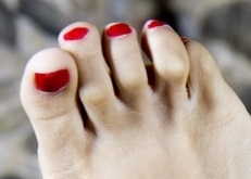 hammertoe foot pain