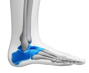 Understand the Symptoms and Causes of Tarsal Tunnel Syndrome