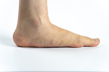 Stretches You Can Perform to Help Heal a Sprained Ankle - Advanced Foot &  Ankle Care Specialists