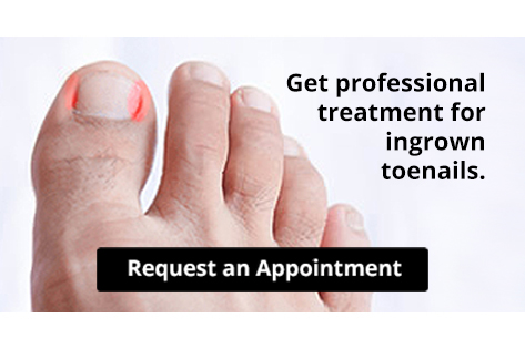 Are You Suffering From Ingrown Toenails? - Advanced Foot & Ankle Care  Specialists