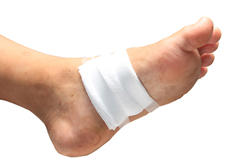 Treating a Wound on the Bottom of the Foot - Advanced Foot & Ankle